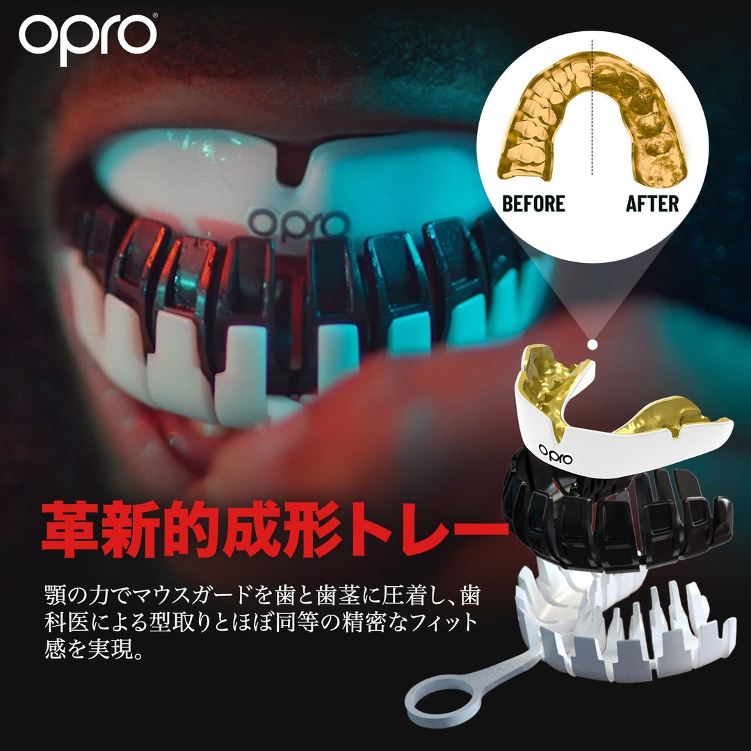歯科医のカスタムマウスピースはなぜ高い？OPROインスタントカスタムフィットという選択肢 - OPRO公式ストア