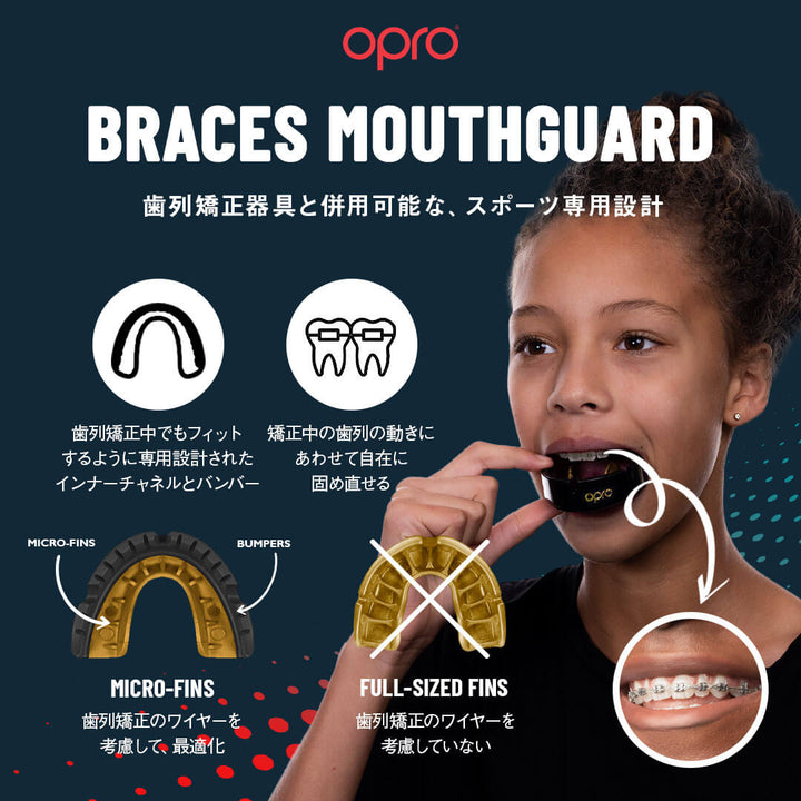 インスタントカスタムフィット/BRACES/黒&白 - OPRO TOKYO